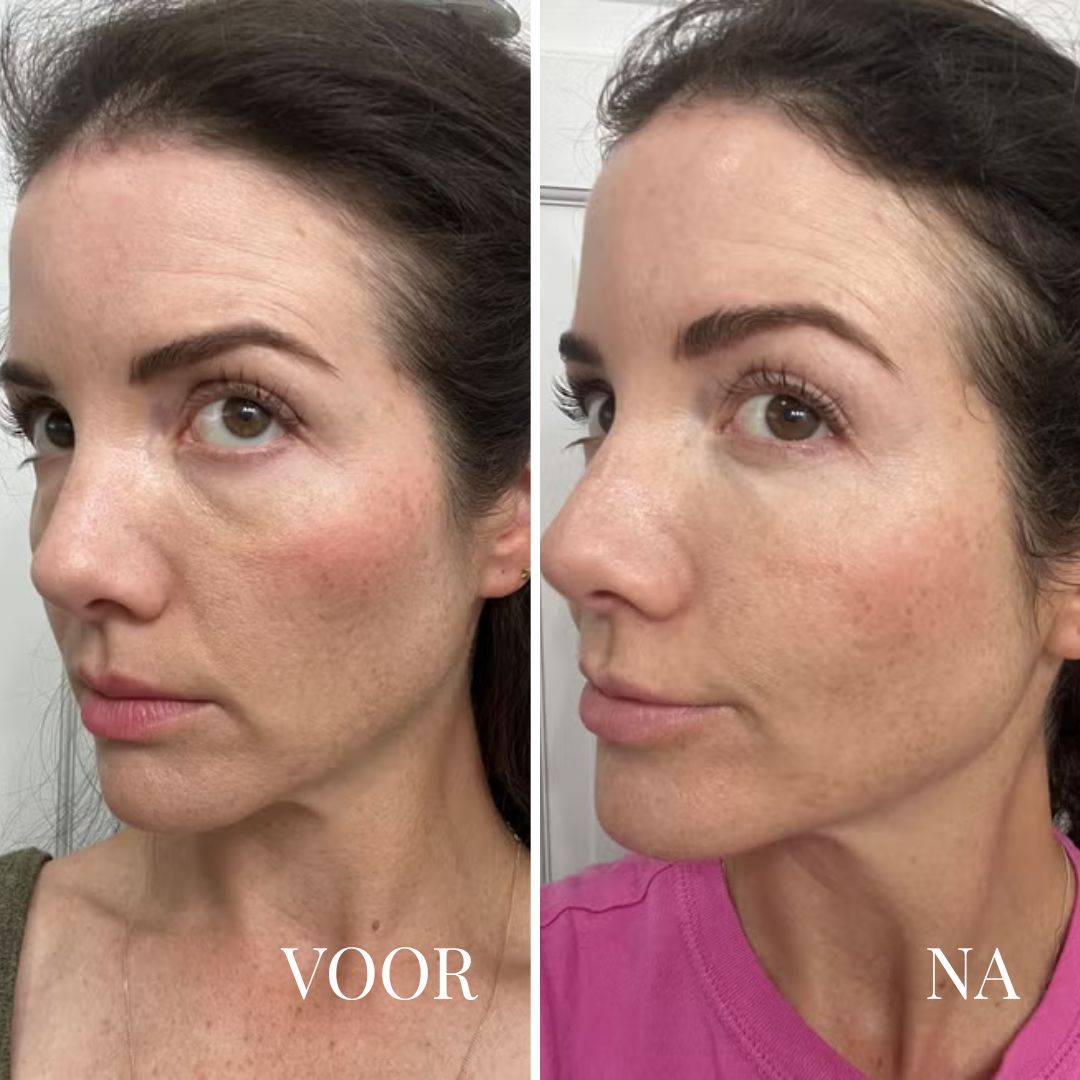 Dr. Melaxin - Velouria Morning Glow Cream