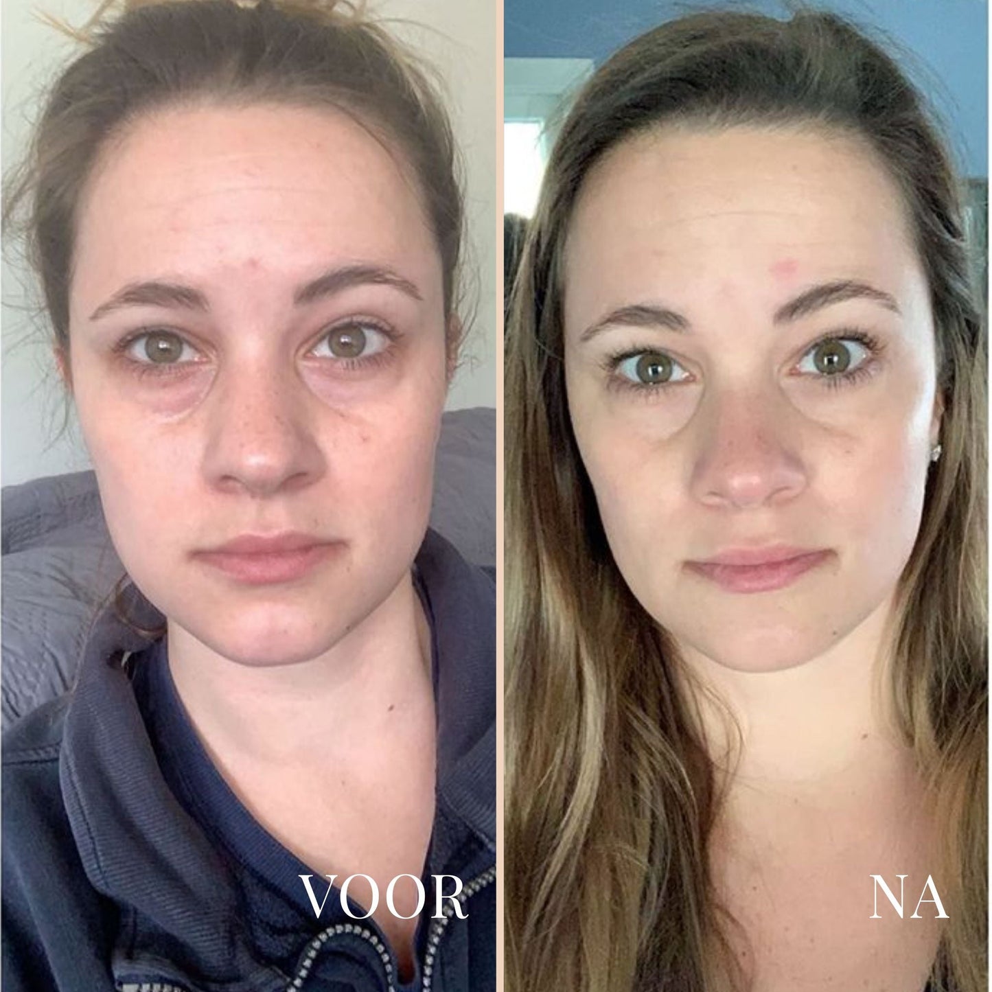 Lina Lift Nek en Oog Versterker Creme