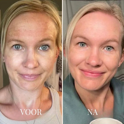 FRESHLIFT | KOREAANS COLLAGEENMASKER VOOR DE RIJPE HUID