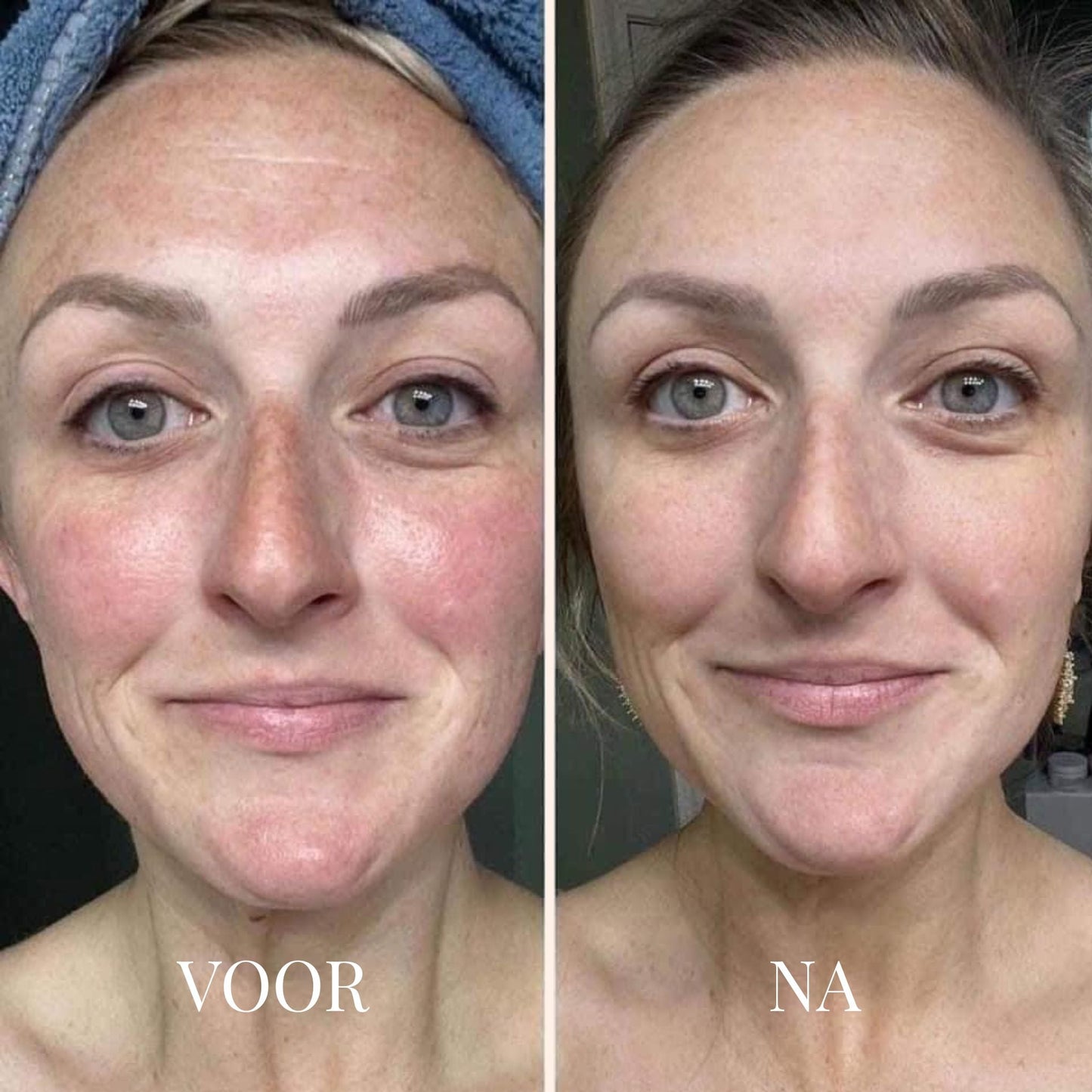 FRESHLIFT | KOREAANS COLLAGEENMASKER VOOR DE RIJPE HUID