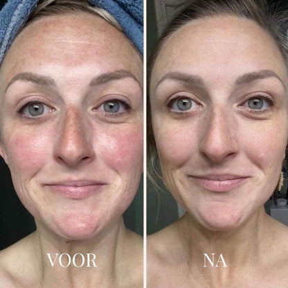 FRESHLIFT | KOREAANS COLLAGEENMASKER VOOR DE RIJPE HUID