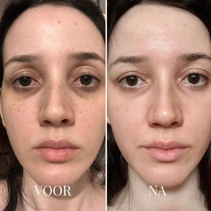FRESHLIFT | KOREAANS COLLAGEENMASKER VOOR DE RIJPE HUID