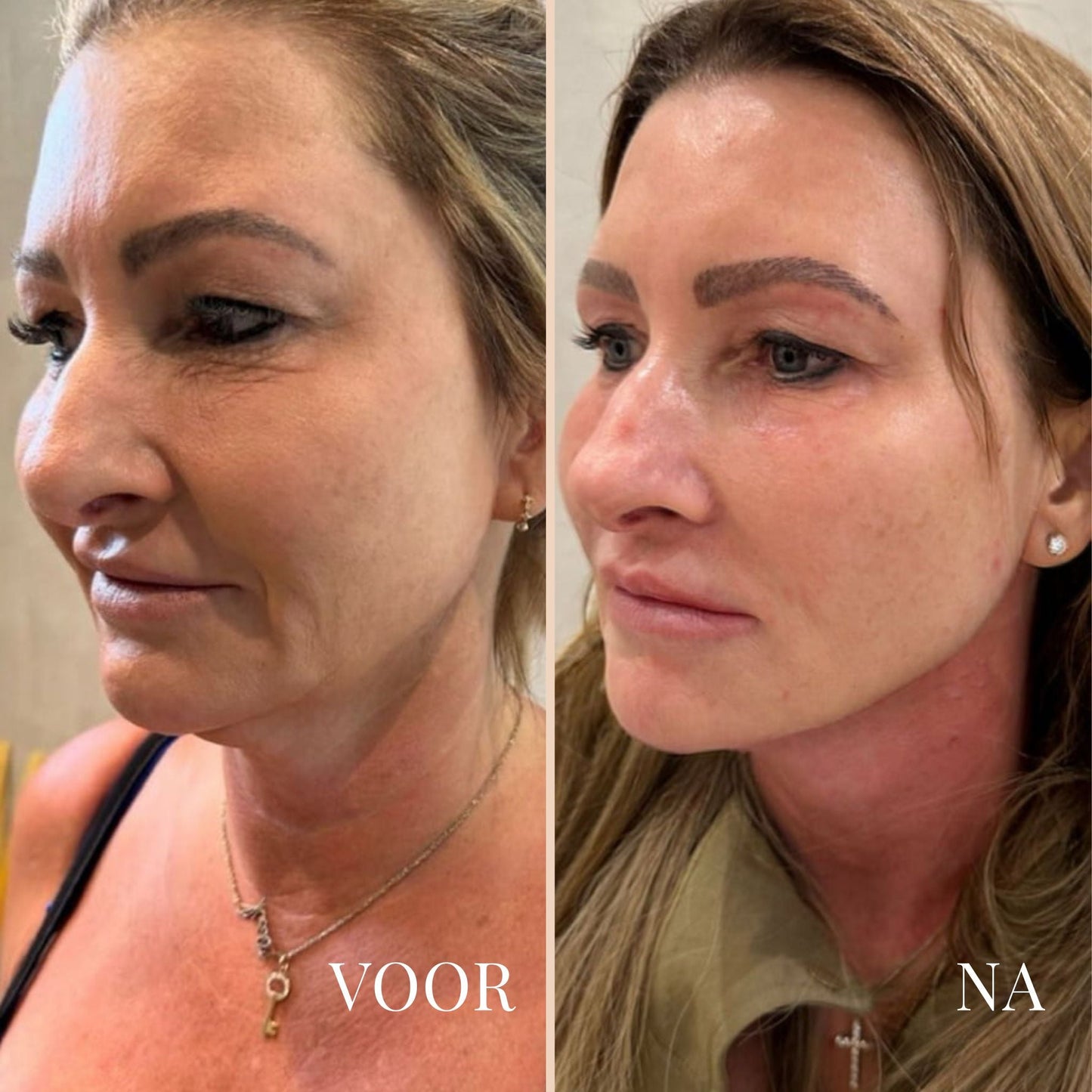 Lina Lift Nek en Oog Versterker Creme