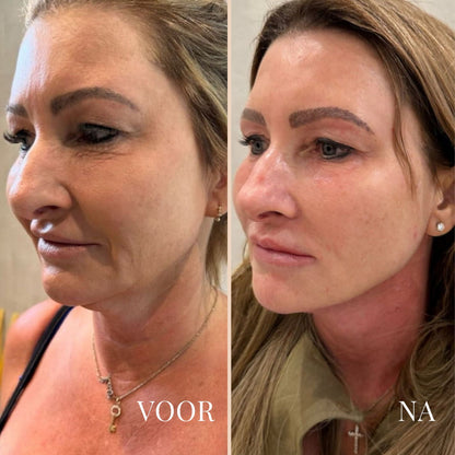 Lina Lift Nek en Oog Versterker Creme