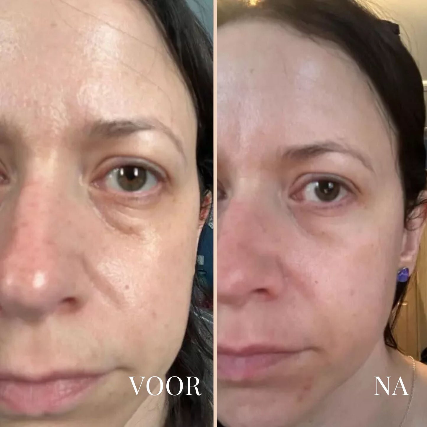 Lina Lift Nek en Oog Versterker Creme