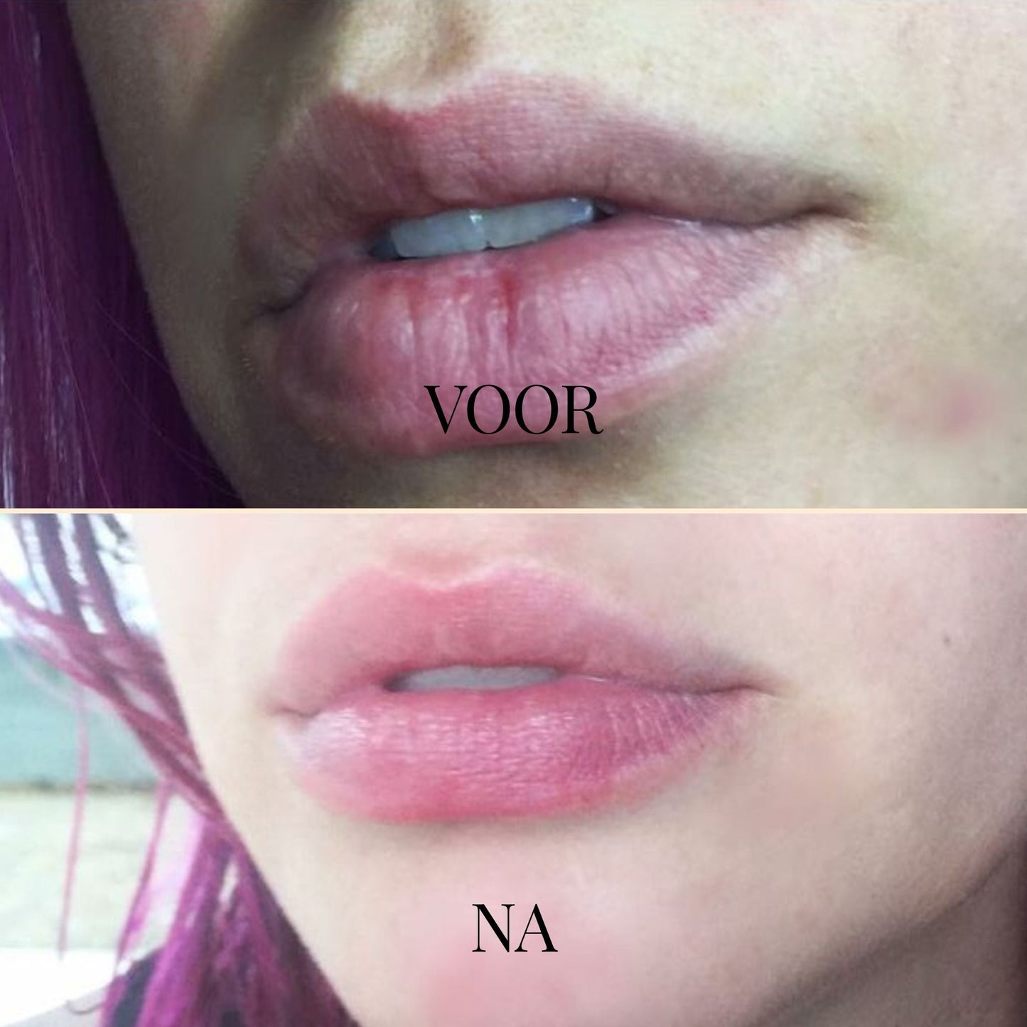 DewKiss Lipbalsem