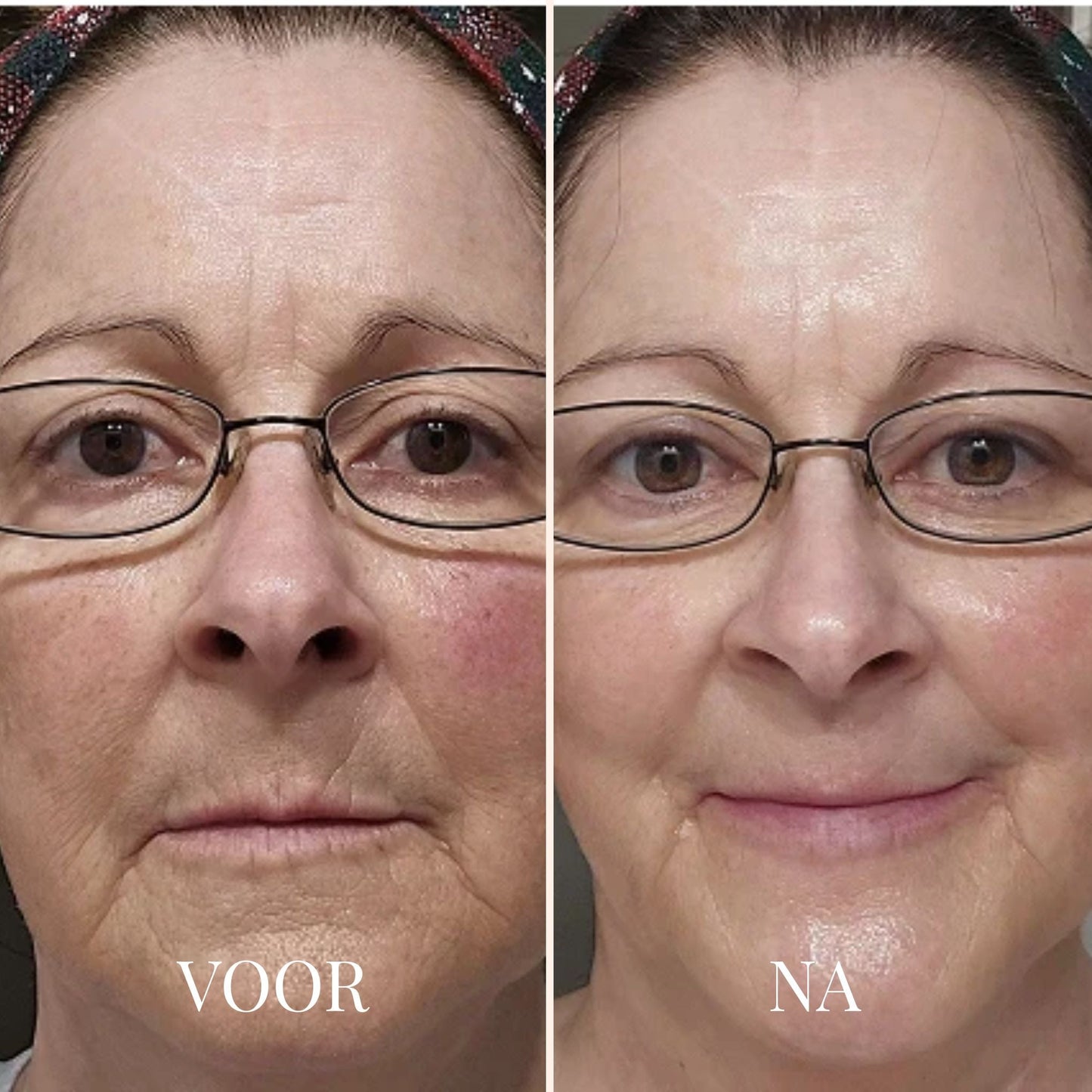 FRESHLIFT | KOREAANS COLLAGEENMASKER VOOR DE RIJPE HUID