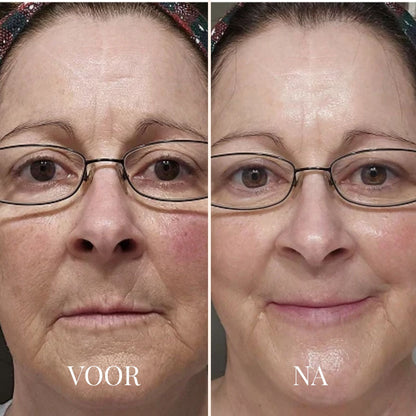 FRESHLIFT | KOREAANS COLLAGEENMASKER VOOR DE RIJPE HUID