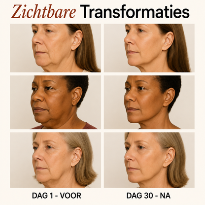 Velouria Sculptiva NeckLift - LED Nek & Kin Behandeling