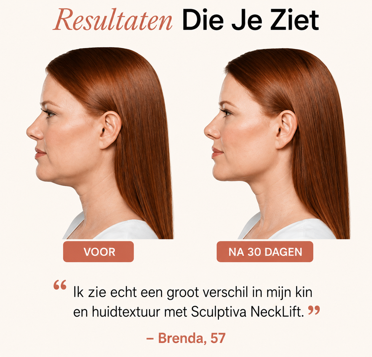 Velouria Sculptiva NeckLift - LED Nek & Kin Behandeling