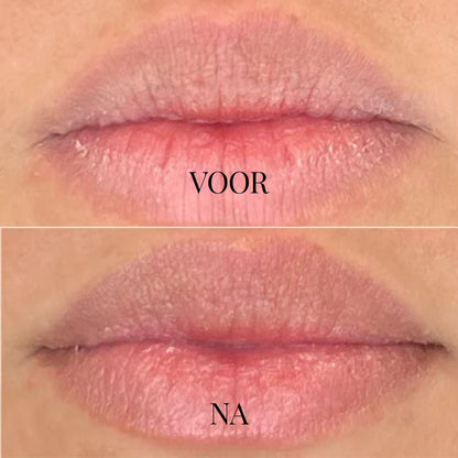 DewKiss Lipbalsem