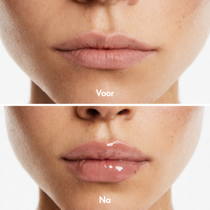 Lip Plumper