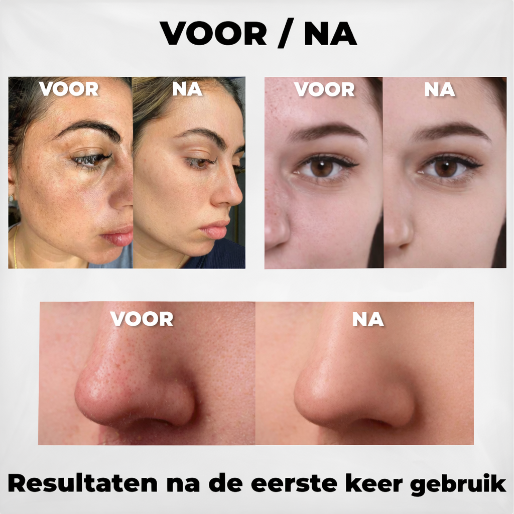Dr. Melaxin Porie Cleaner