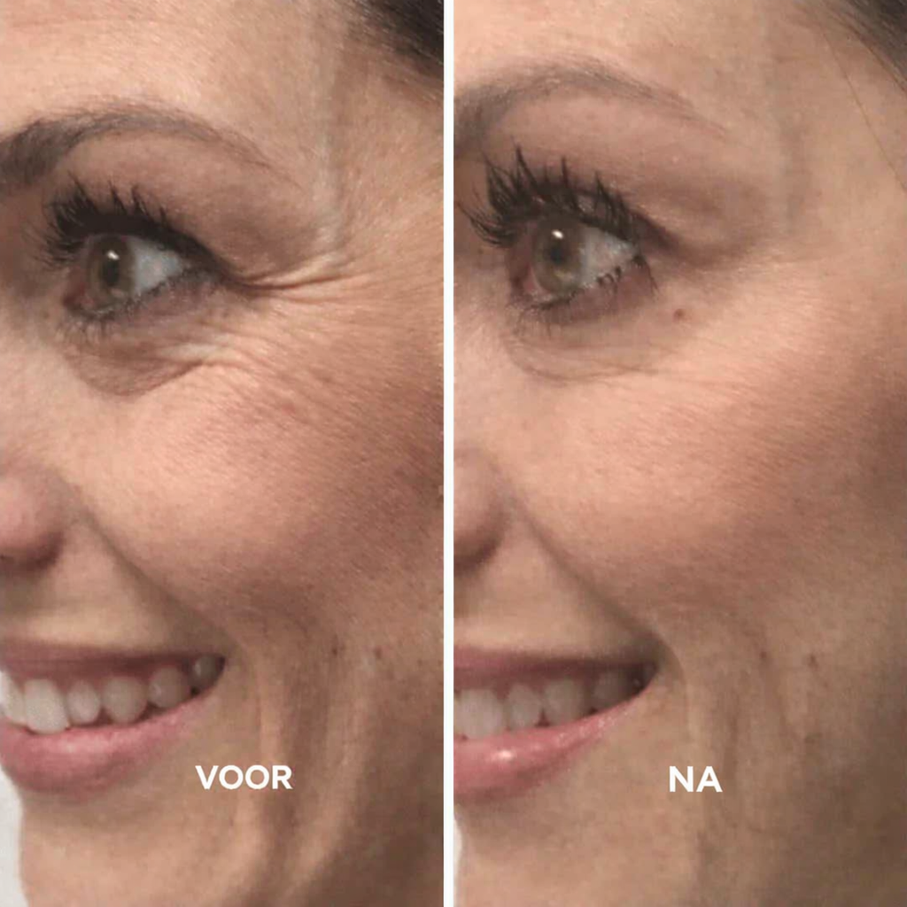 Retinal Balance Collageen Lift Serum