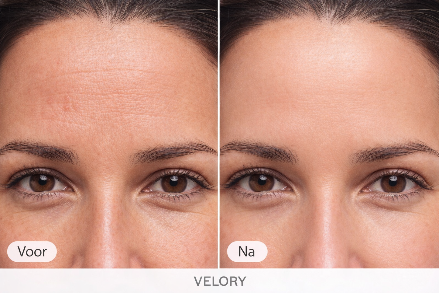 The Collagen Mask